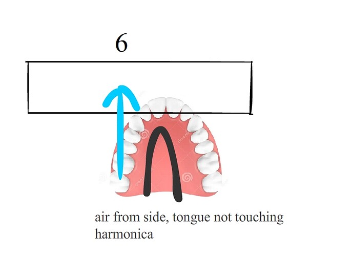 Ambrachure